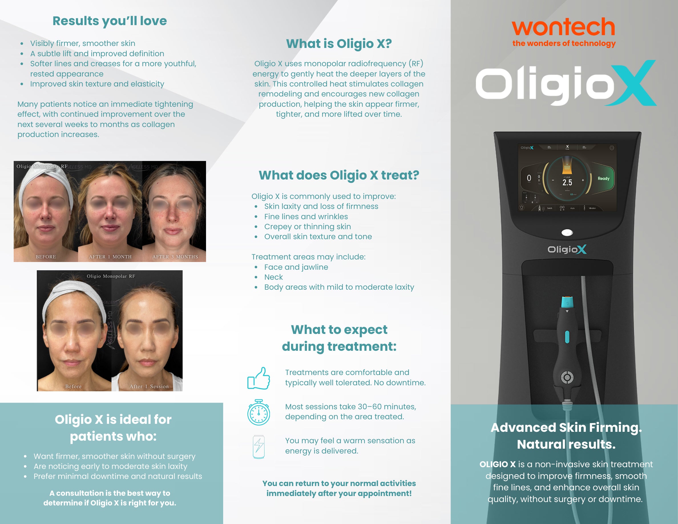 Oligio X Patient Brochure Pack (25 Count)