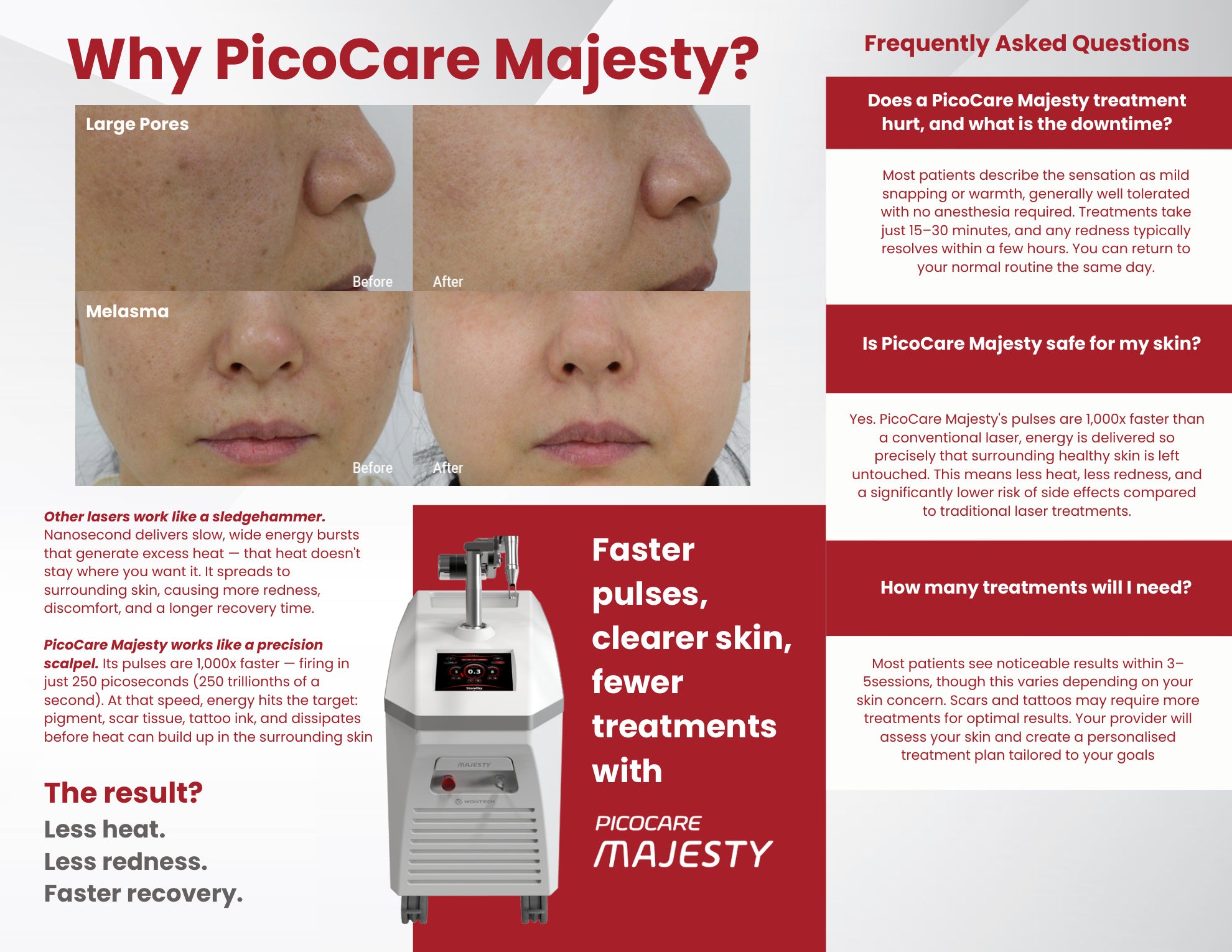 PicoCare Majesty Patient Brochure Pack (25 Count)