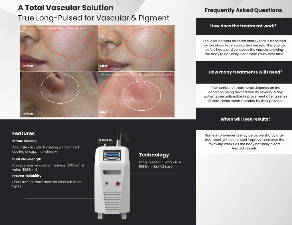 V-Laser Patient Brochure Pack (25 Count)